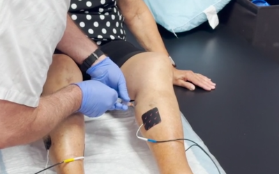 Your Guide to Preventing Diabetic Neuropathy Today