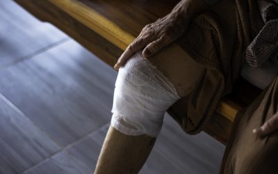 Chronic Wounds: Why Some Injuries Refuse to Heal